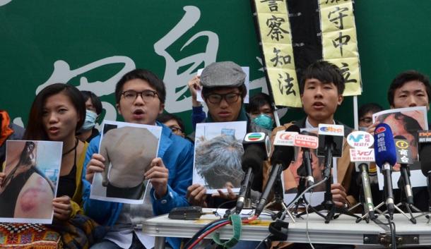 官庁街・金鐘（アドミラルティ）の占拠現場で会見し、警察に殴られてできた自分の傷の写真を示すデモ参加者たち＝香港