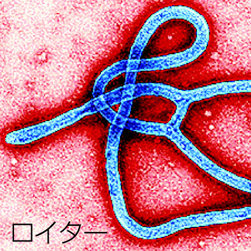エボラウイルスの透過型光学顕微鏡写真（ロイター） 
