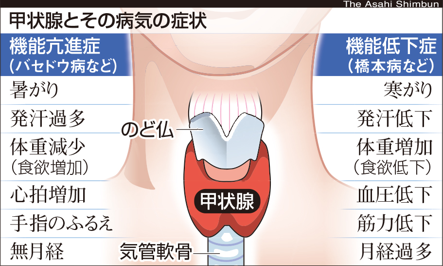 写真・図版 : 