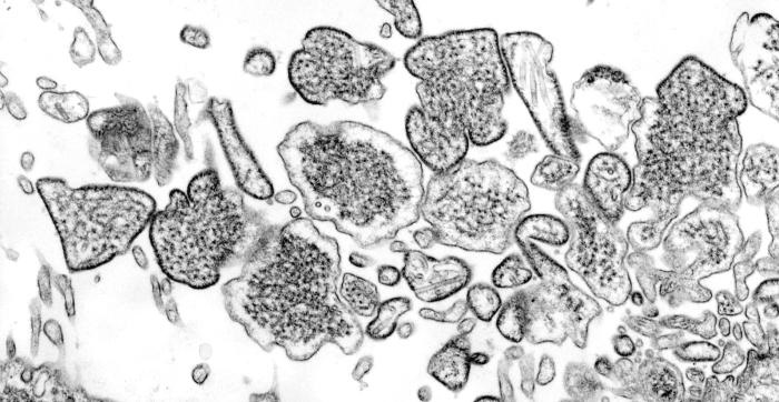 写真・図版 : 電子顕微鏡で見たニパウイルス＝米疾病対策センター提供