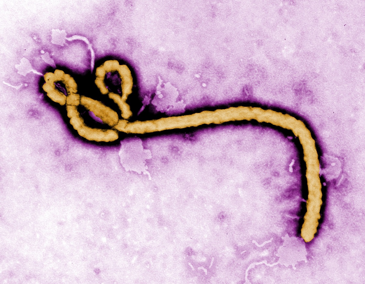 エボラウイルス＝米疾病対策センターのホームページから