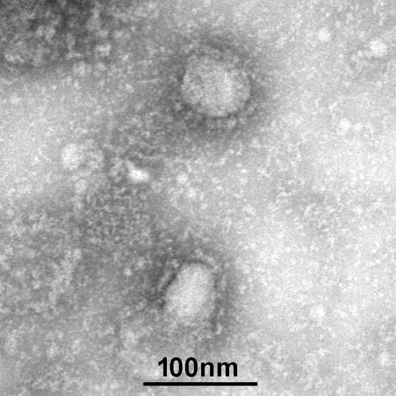 写真・図版 : 中国疾病対策センターが公開した新型コロナウイルスの電子顕微鏡写真 ＝CDC　China提供