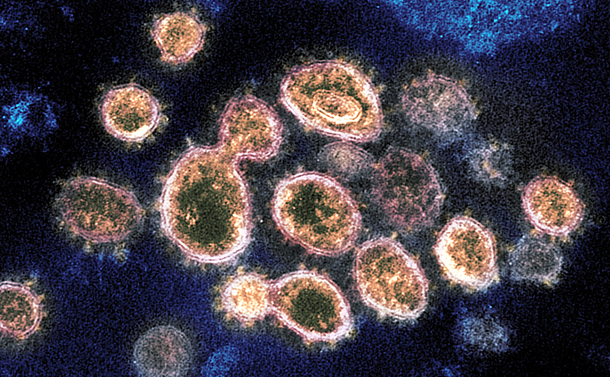 写真・図版 : 電子顕微鏡で見た新型コロナウイルス＝米国立アレルギー・感染症研究所提供 