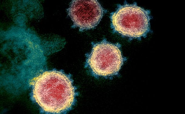 写真・図版 : 新型コロナウイルス「SARS-CoV-2」＝米国立アレルギー・感染症研究所提供