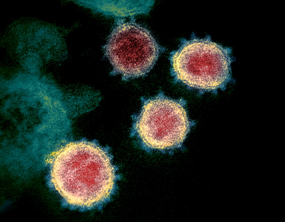 写真・図版 : 新型コロナウイルス「SARS-CoV-2」＝米国立アレルギー・感染症研究所提供