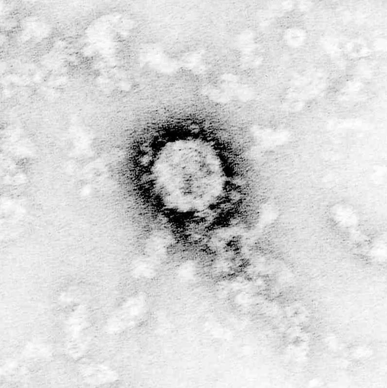 写真・図版 : C型肝炎ウイルス＝国立感染症研究所提供