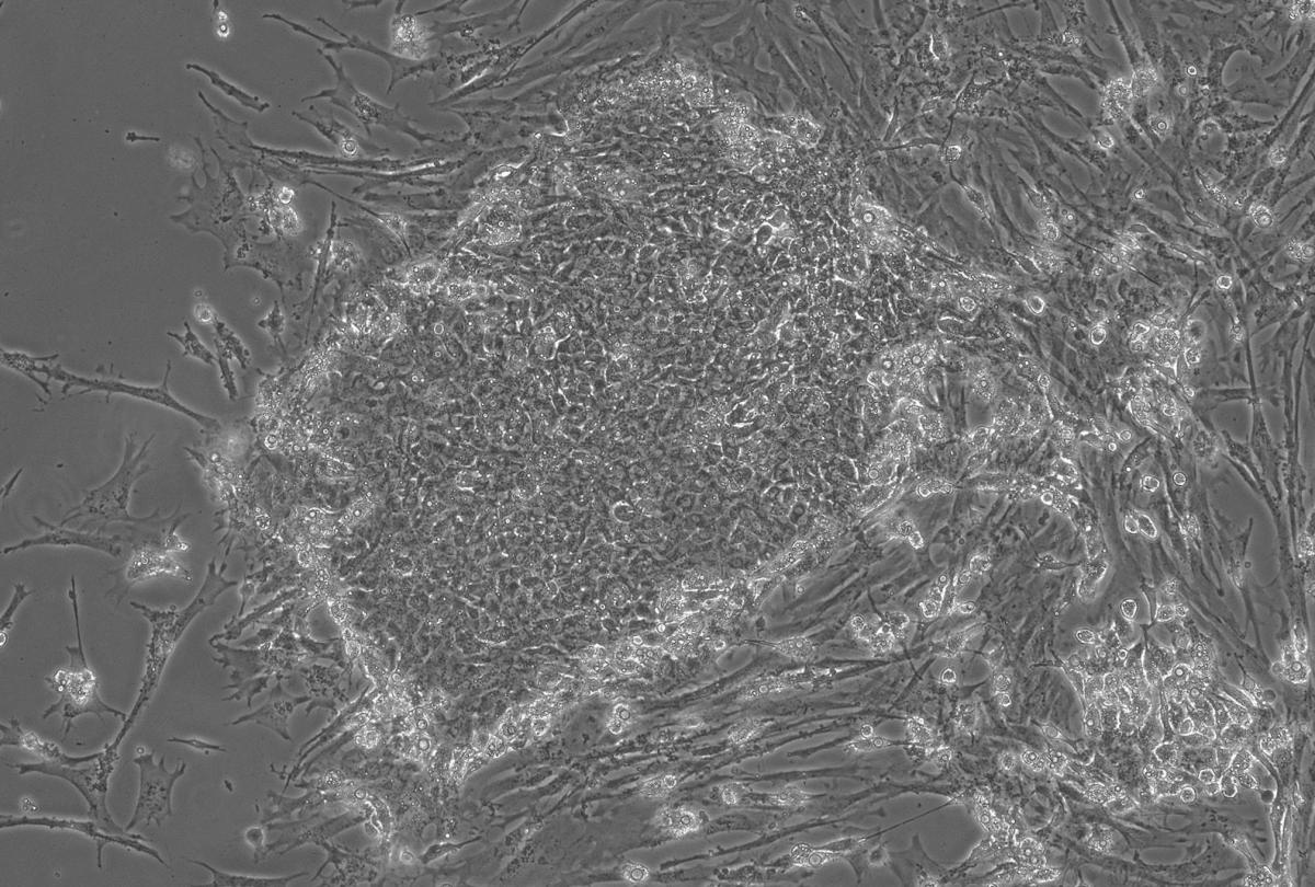 ニワトリの幹細胞由来の培養肉の顕微鏡写真