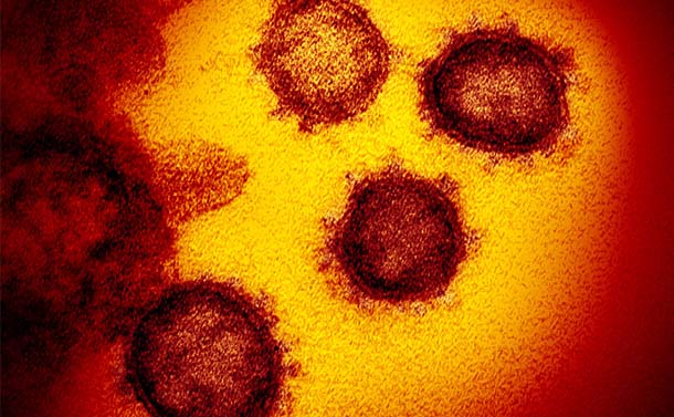写真・図版 : 電子顕微鏡で見た新型コロナウイルス＝米国立アレルギー・感染症研究所提供