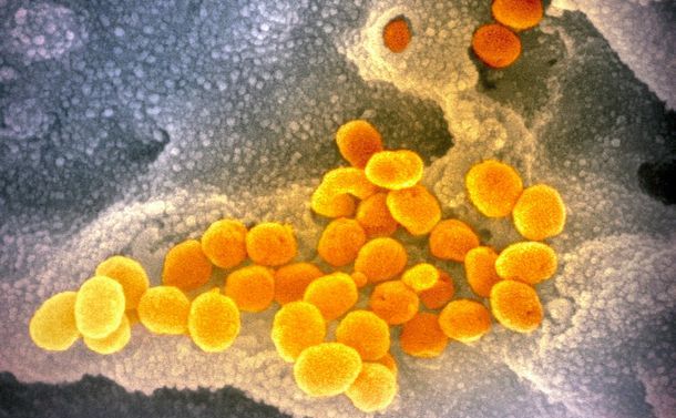 写真・図版 : 電子顕微鏡で見た新型コロナウイルス＝米国立アレルギー・感染症研究所提供