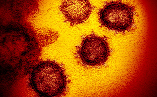 写真・図版 : 新型コロナウイルス＝米国立アレルギー・感染症研究所提供
