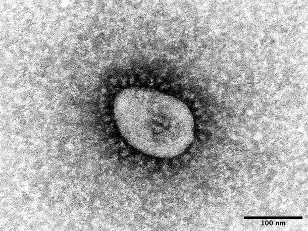 写真・図版 : 国立感染症研究所で分離に成功した新型コロナウイルスのオミクロン株の電子顕微鏡写真＝感染研提供