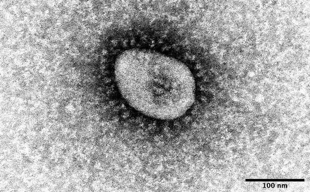 写真・図版 : 国立感染症研究所で分離に成功した新型コロナウイルスのオミクロン株の電子顕微鏡写真＝国立感染症研究所提供