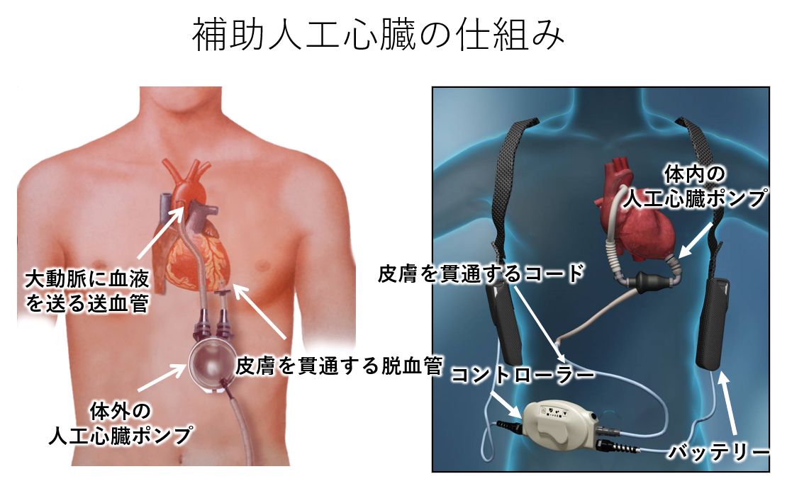 日米で心臓移植患者を診てきた加藤倫子医師の視点２